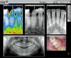dental imaging